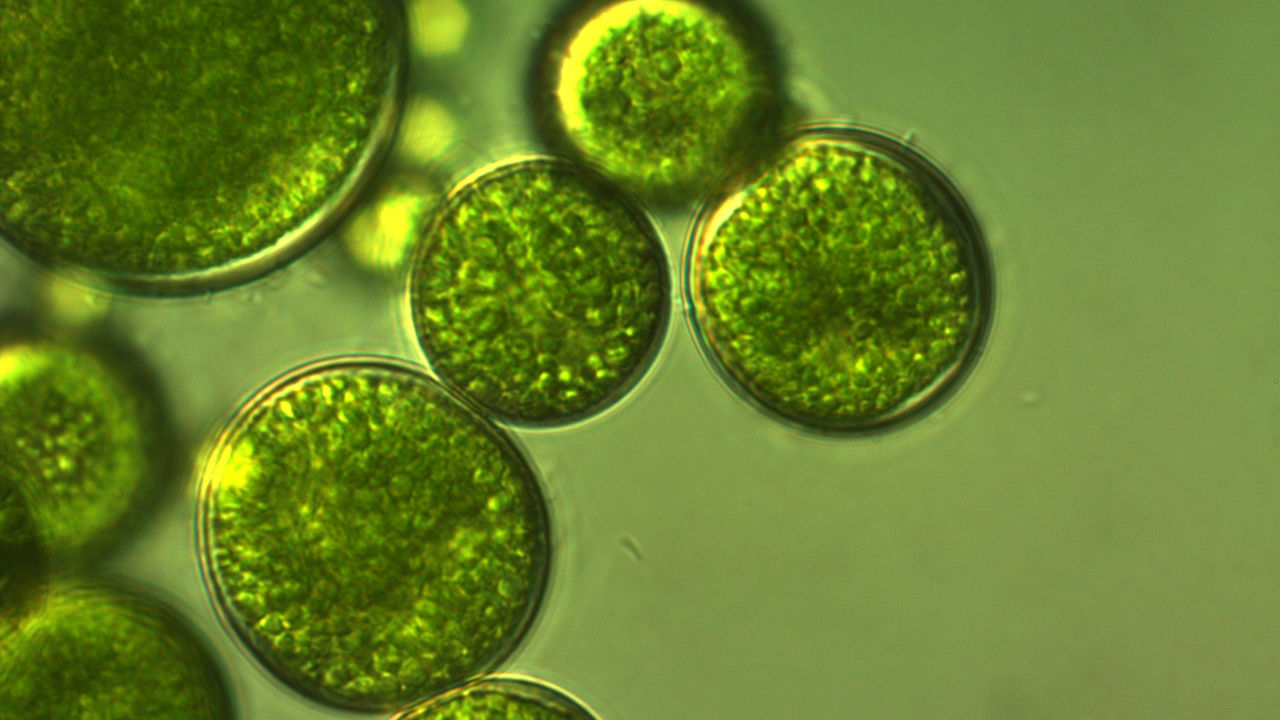 <p>Jednoćelijske alge</p>